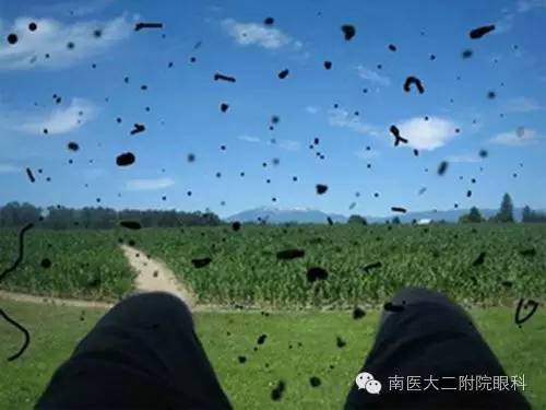 警惕，近視眼更容易得飛蚊癥