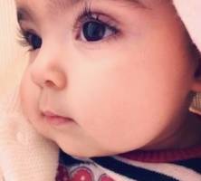 寶寶愛流眼淚,原來(lái)是倒睫毛作怪 寶寶愛流眼淚,原來(lái)是倒睫毛作怪