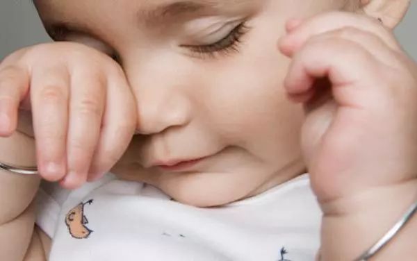 眼分泌物多是病嗎? 眼分泌物多是病嗎?