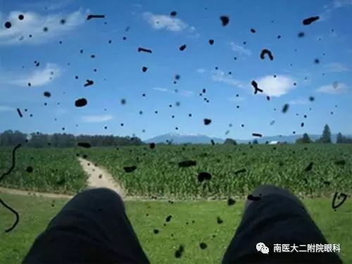 患病率最高的三種眼睛疾病 患病率最高的三種眼睛疾病