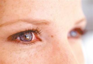 眼睛干癢怎么辦？