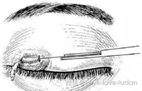 夏天里眼睛有四怕，您知道嗎？