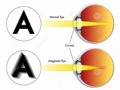 和你談談關于結膜炎的那些事