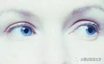 轉眼珠能提高記憶力？還改善視力？