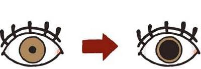 散瞳檢查那些事兒