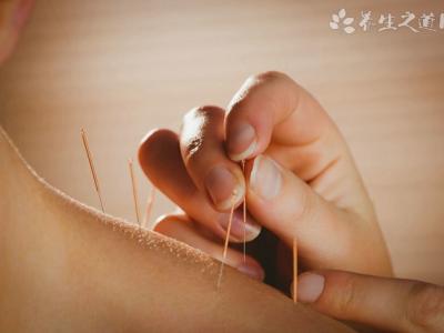 針灸后多久可以洗澡