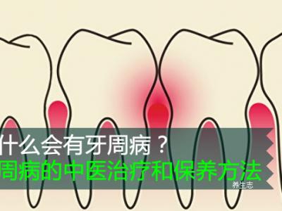 怎么會有牙周病?牙周病的中藥治療和維護保養(yǎng)方式