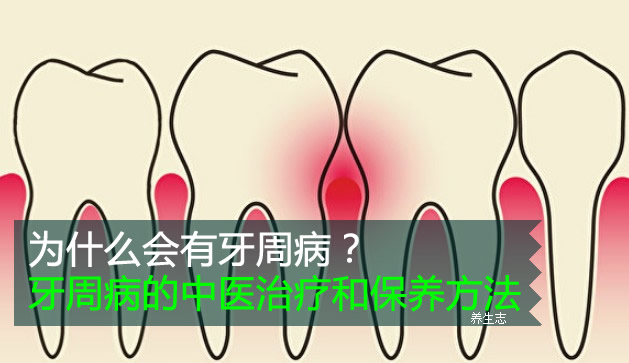 為什么會有牙周病?牙周病的中醫治療和保養方法-易網健康<a href=http://www.jsjjzhkt.cn/jkys/ target=_blank class=infotextkey>養生</a>網 為什么會有牙周病?牙周病的中醫治療和保養方法