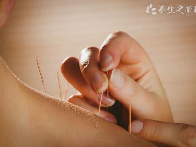 針灸后身體會虛嗎