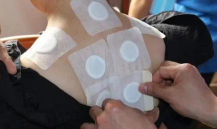 三伏貼必須入伏當天貼嗎-易網健康<a href=http://www.jsjjzhkt.cn/jkys/ target=_blank class=infotextkey>養生</a>網 三伏貼必須入伏當天貼嗎