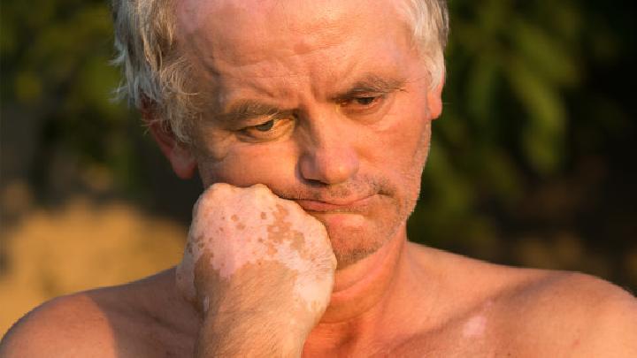 中醫(yī)針灸會(huì)不會(huì)疼? 這4種人不適合做針灸