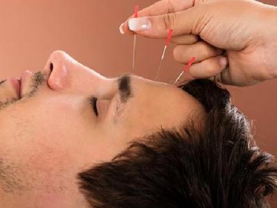 中醫針灸怎么治療酒渣鼻 兩個酒渣鼻的針灸治療方法