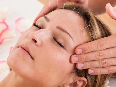 中醫針灸常見的4種好處須知 這7類人針灸需注意