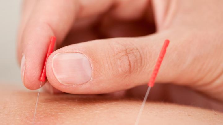 視神經(jīng)萎縮的癥狀是什么 中醫(yī)針灸治療視神經(jīng)萎縮有奇效