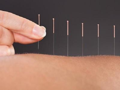 高血脂最好的治療方法有哪些 治療高血脂可考慮中醫針灸