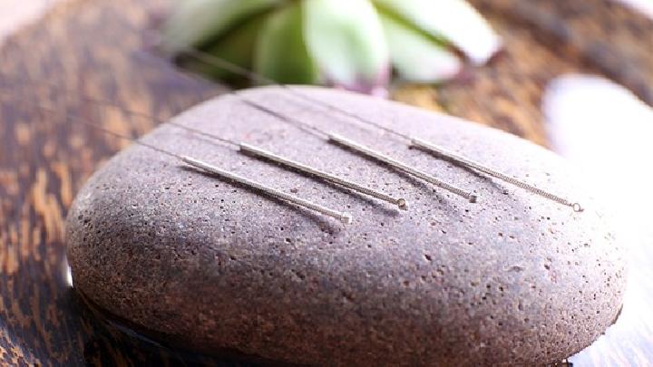 中醫(yī)治鼻咽癌的針灸療法有哪些 中醫(yī)針灸治鼻咽癌的四個療法-易網(wǎng)<a href=http://www.jsjjzhkt.cn/ target=_blank class=infotextkey>健康養(yǎng)生</a>網(wǎng) 中醫(yī)治鼻咽癌的針灸療法有哪些 中醫(yī)針灸治鼻咽癌的四個療法