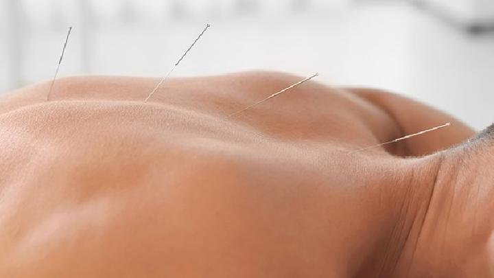 煩人鼻炎怎么治療才能康復 中醫針灸治療鼻炎的四個方面