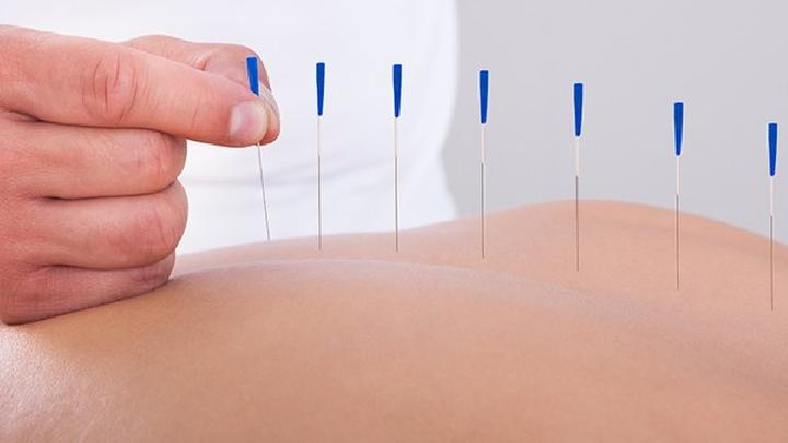 發現中風后如何選擇就醫? 中醫針灸對治療中風的作用介紹-易網健康<a href=http://www.jsjjzhkt.cn/jkys/ target=_blank class=infotextkey>養生</a>網 發現中風后如何選擇就醫? 中醫針灸對治療中風的作用介紹