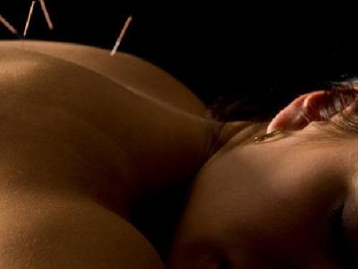 中醫針灸治痛經疼嗎 中醫針灸治痛經的注意事項