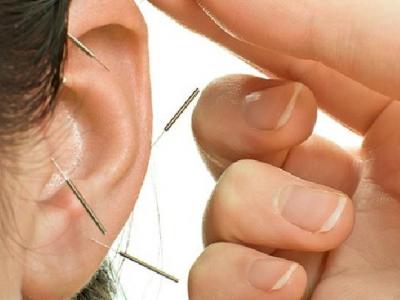 中醫治療脫發可試試針灸療法 中醫食療治脫發需注意四個事項
