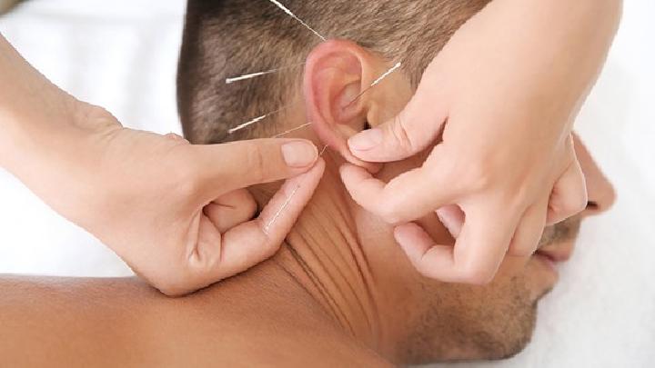 中醫(yī)怎么運(yùn)用穴位針灸治療痤瘡 中醫(yī)針灸治療痤瘡的兩個(gè)方面