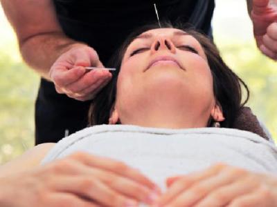 中醫(yī)針灸治療斑禿的方法是什么 中醫(yī)治斑禿的5種針灸療法