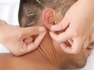 中醫(yī)怎么運(yùn)用穴位針灸治療痤瘡 中醫(yī)針灸治療痤瘡的兩個方面