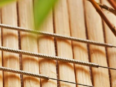 中醫(yī)針灸治蕁麻疹需要注意些什么 中醫(yī)針灸治蕁麻疹有三大止癢要點