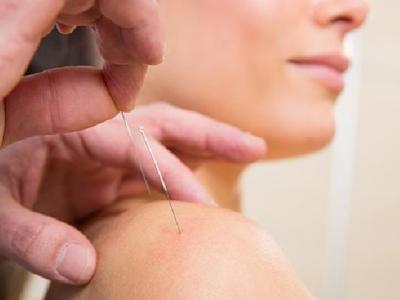 中醫怎樣治雀斑效果最好 中醫針灸+食療可助祛斑與嫩膚