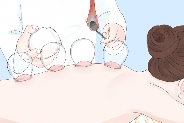 拔火罐有什么好處-易網(wǎng)健康<a href=http://www.jsjjzhkt.cn/jkys/ target=_blank class=infotextkey>養(yǎng)生</a>網(wǎng) 拔火罐有什么好處