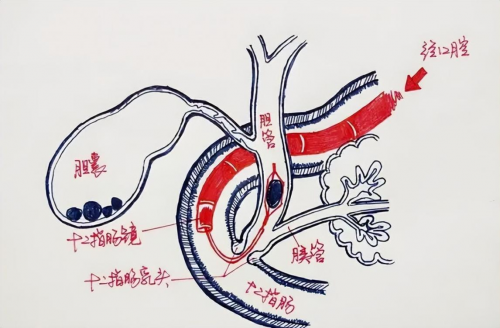 十一代中醫于海燕:探秘壯血藥酒與中醫智慧,守護健康之道-易網健康養生網 十一代中醫于海燕:探秘壯血藥酒與中醫智慧,守護健康之道